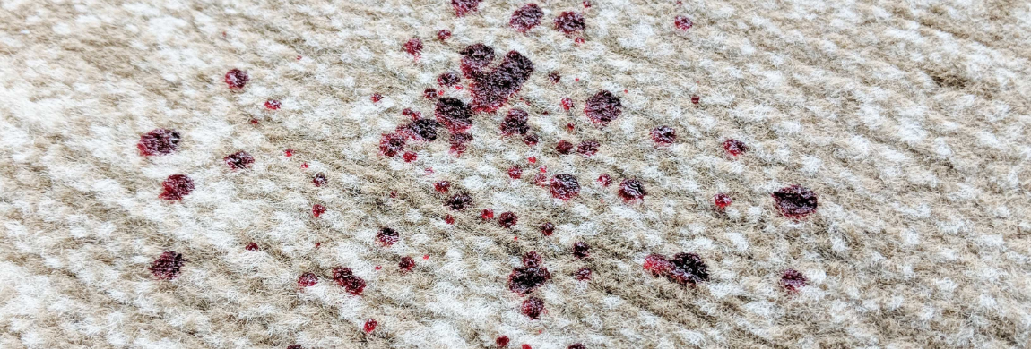 Removing Blood Stains From Carpet